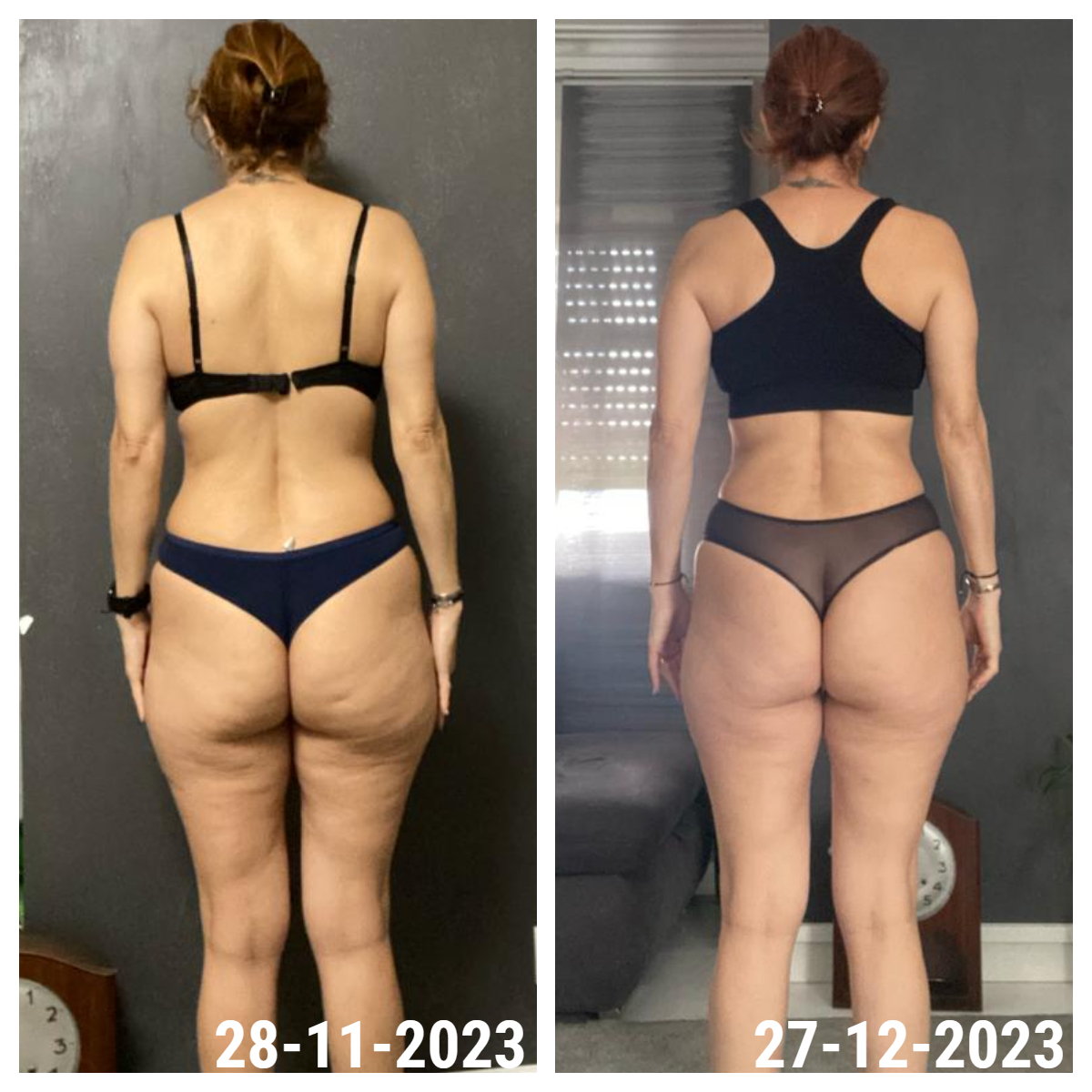 Resultado antes e depois de uma aluna INSHAPE