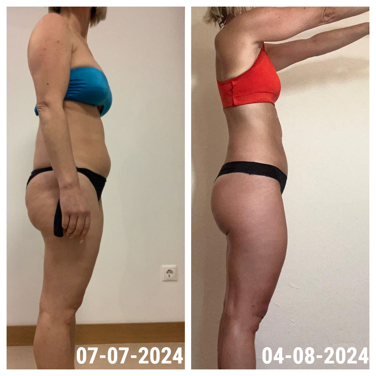 Resultado antes e depois de uma aluna INSHAPE